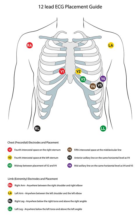 12 Lead Ecg