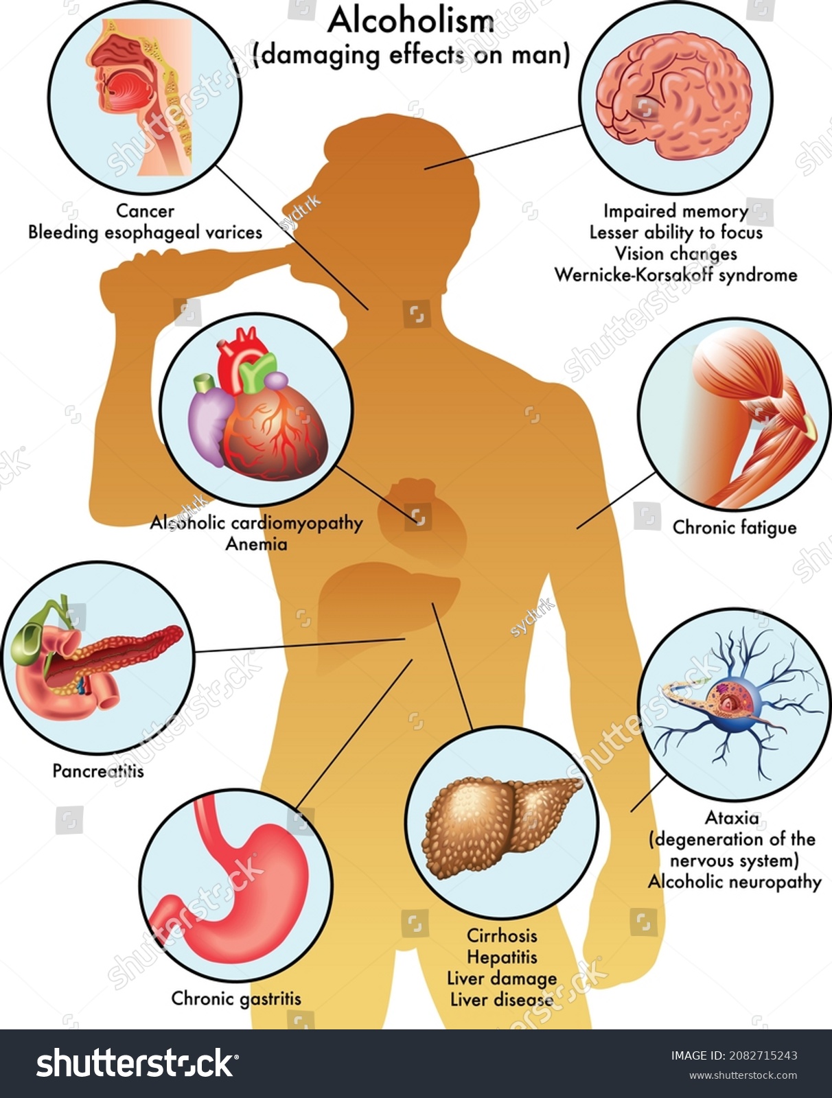 Alcohol And Antibiotics Doxycycline