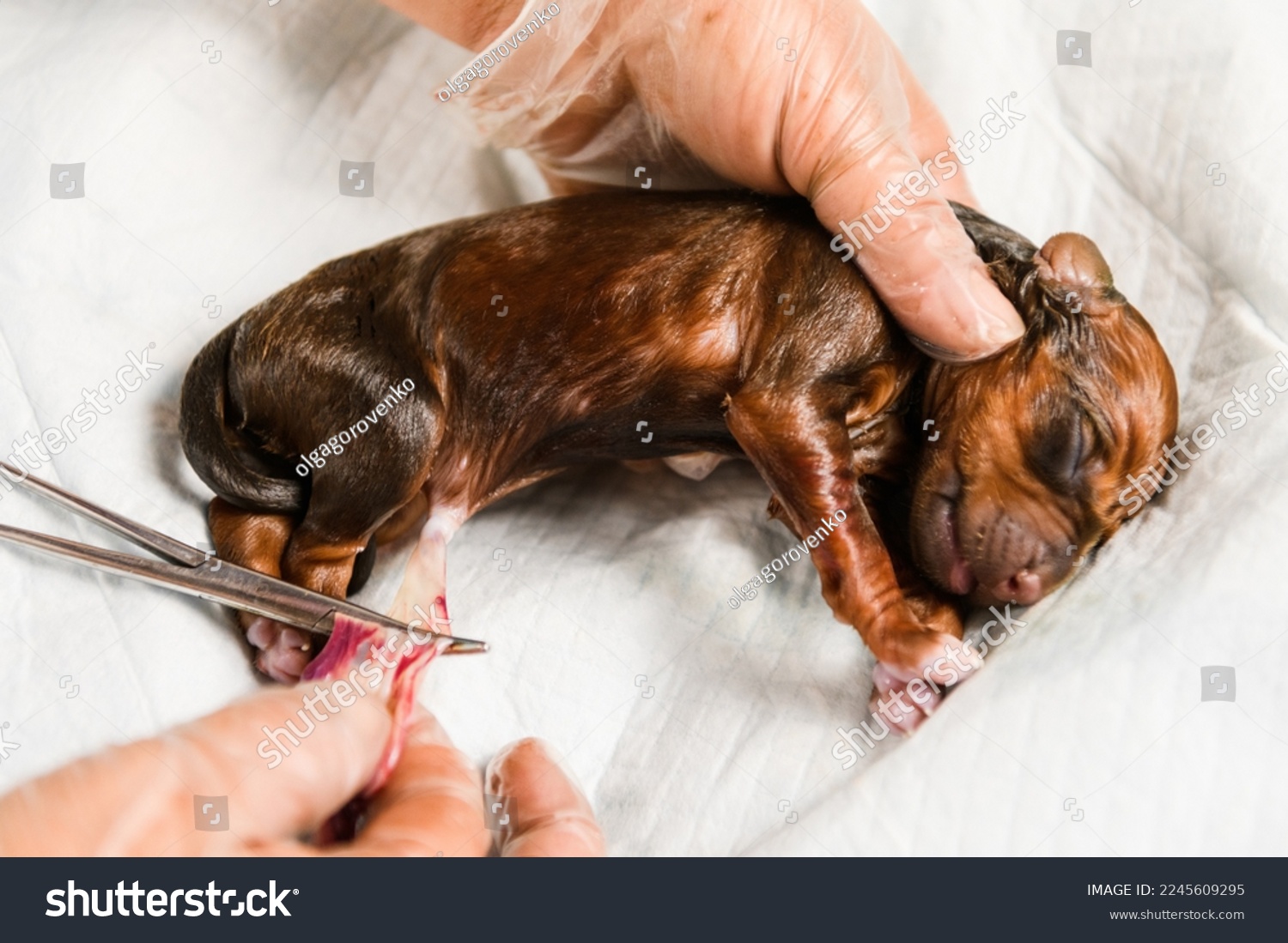 Amniotic Fluid Test