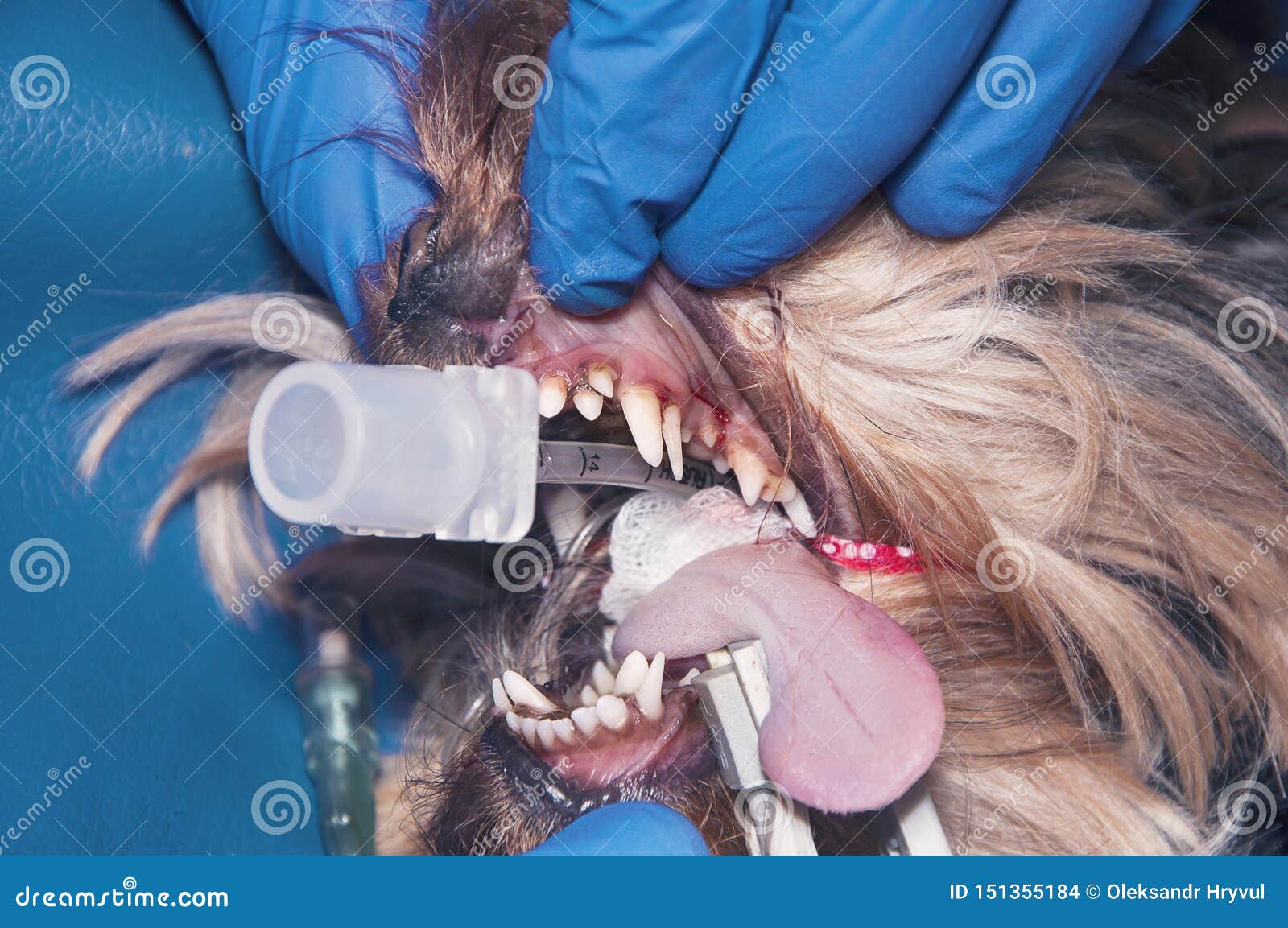 Anesthesiologists Vs Crna
