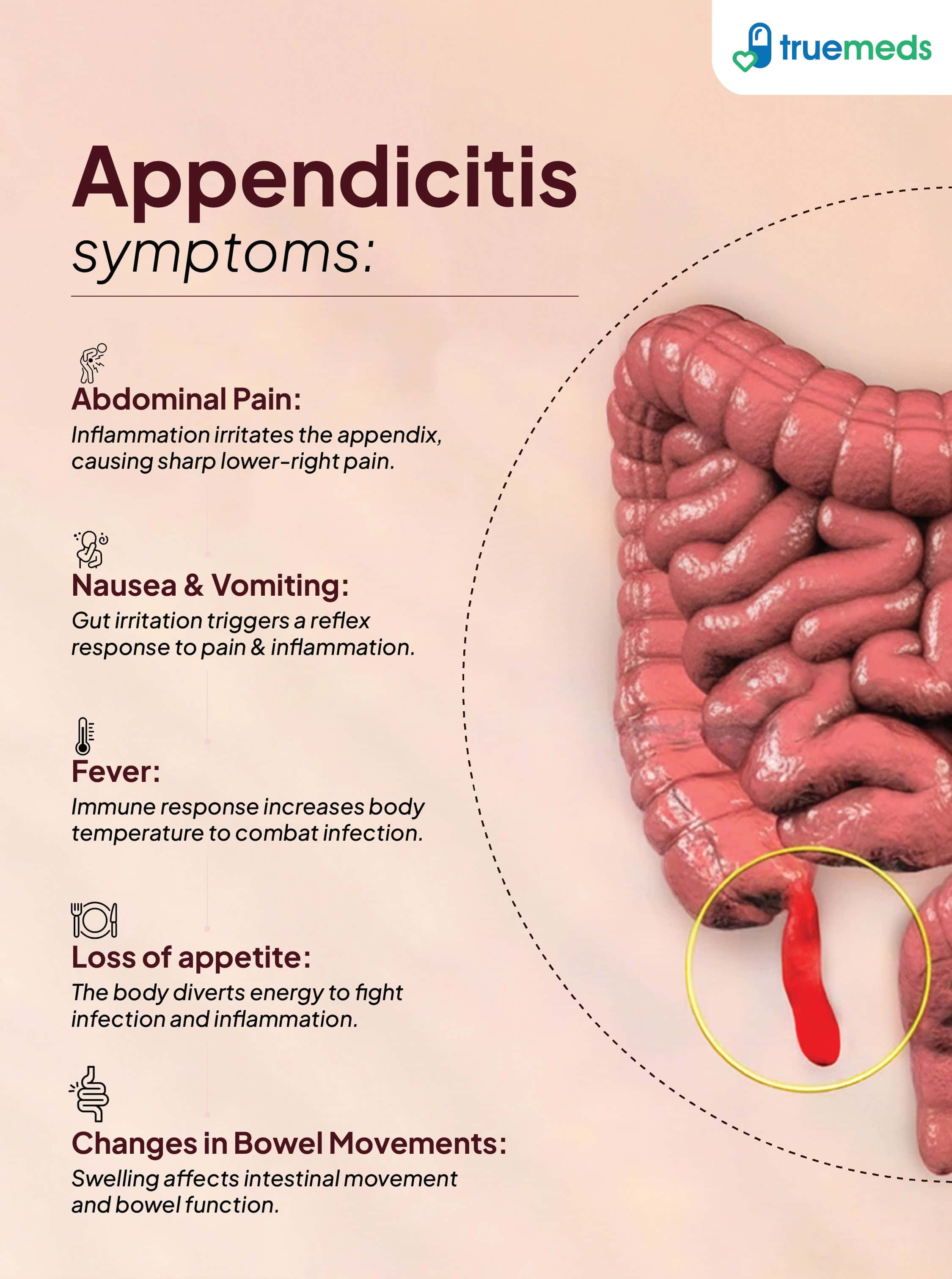 Appendicitis In Children