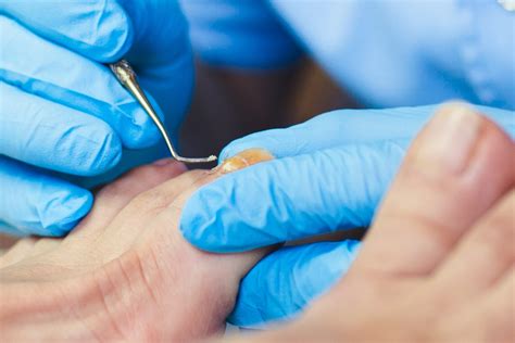 Are Chiropodists Medical Doctors