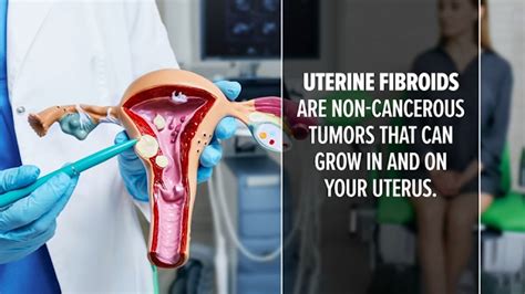 Are Fibroids Cancerous