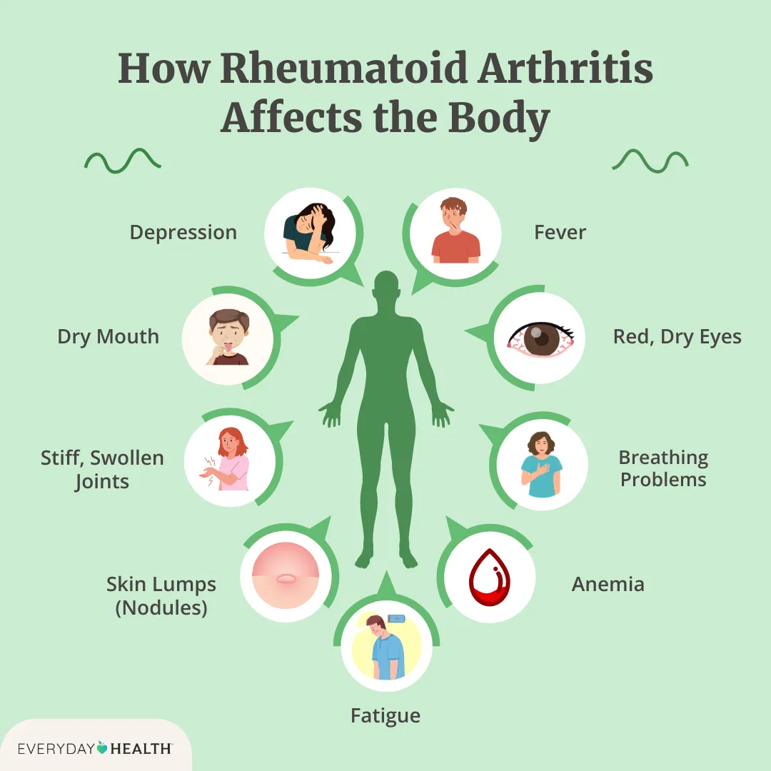 Arthritis In The Neck