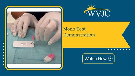At Home Mono Test