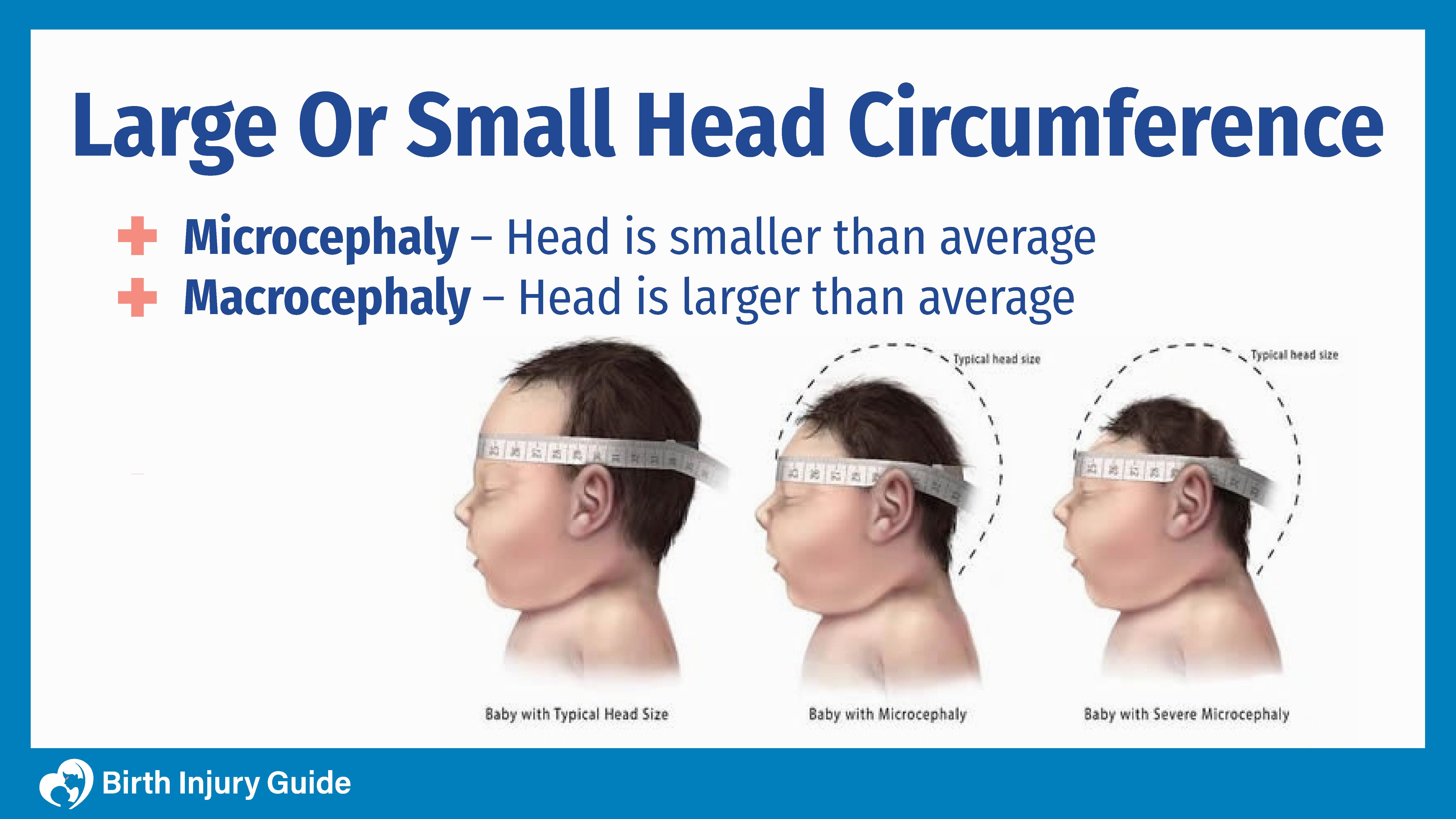 What Is The Average Size Of A Baby Head At Birth?