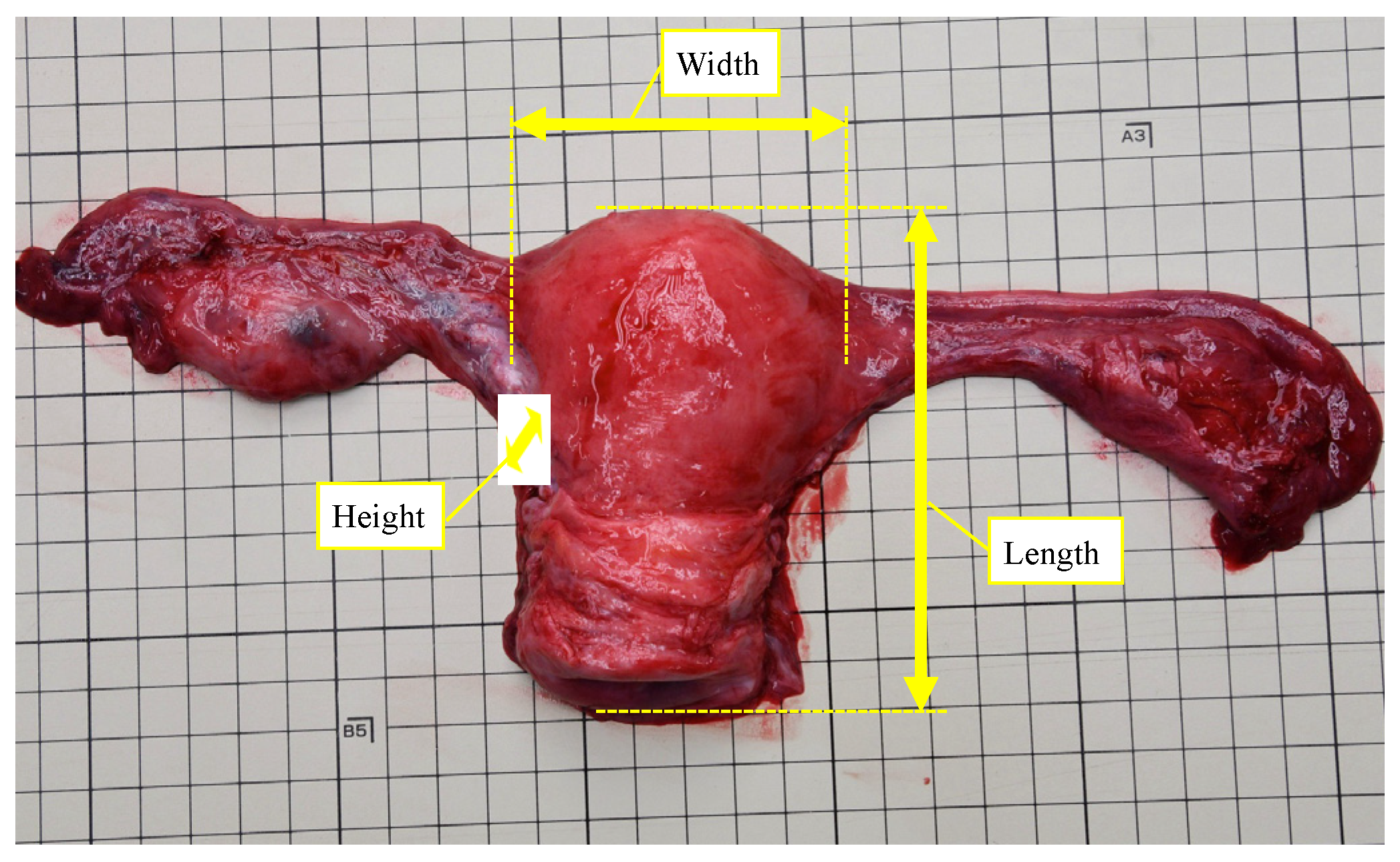 Understanding The Average Size Of A Uterus In Centimeters