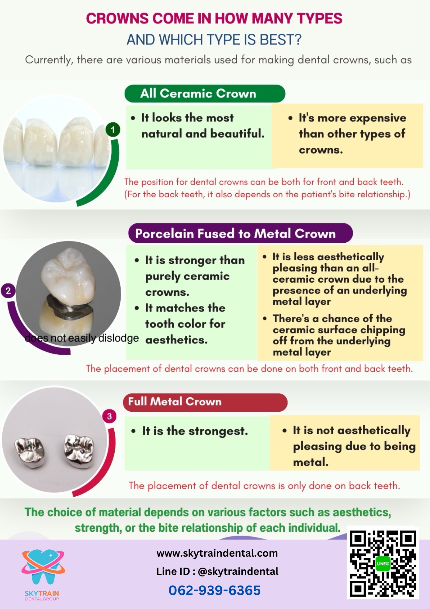 Choosing The Best Material For Dental Crowns In 2026