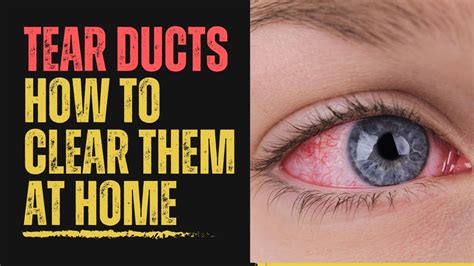 Blocked Tear Duct Home Remedy