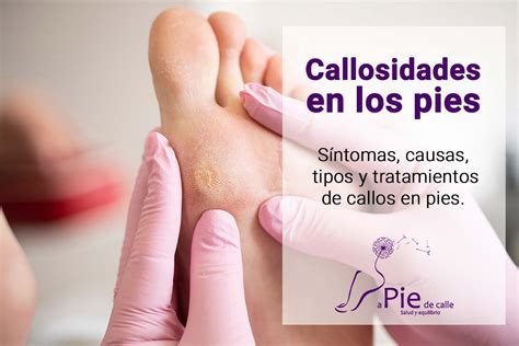 Cadillos En Los Pies