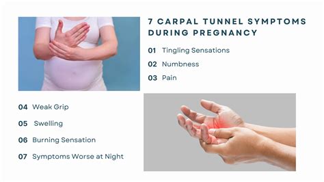 Carpal Tunnel During Pregnancy