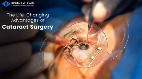 Cataract Eye Surgery Procedure