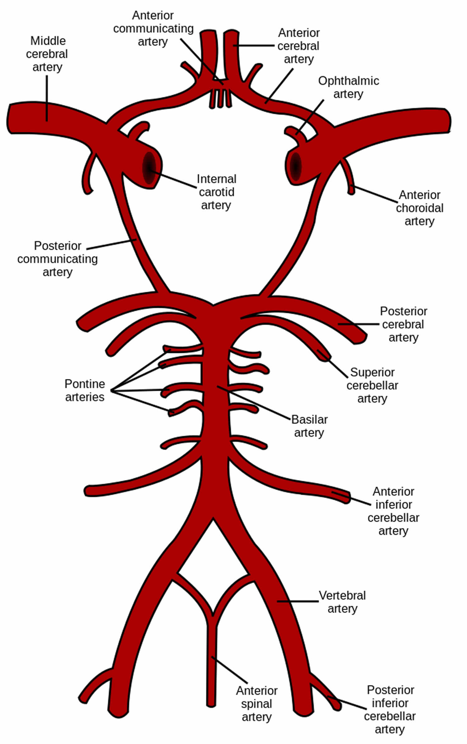 Cerebral Hemorrhage Causes