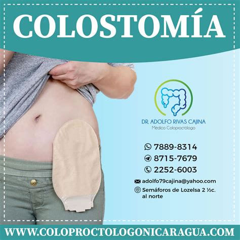 Colostomia Que Es