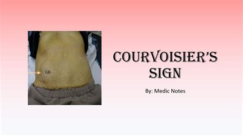 Courvoisier Terrier Sign