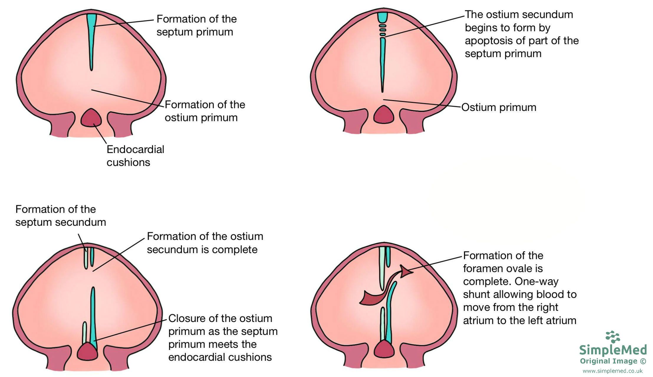 Understanding The Embryological Development Of The Interventricular Septum