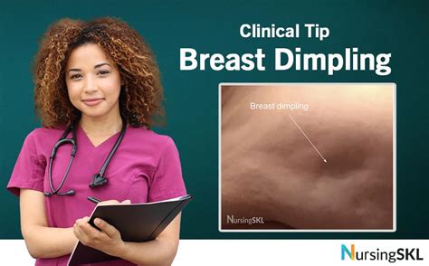 Dimple On Boob