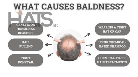 Do Hats Cause Hair Loss