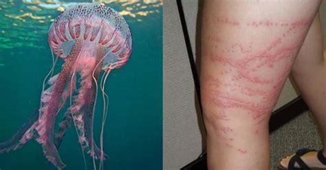 Do Jellyfish Sting Everything They Touch
