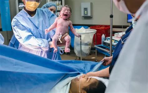 Do They Move Organs For C Section