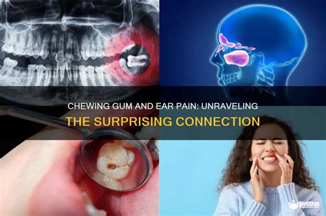 Earache While Chewing
