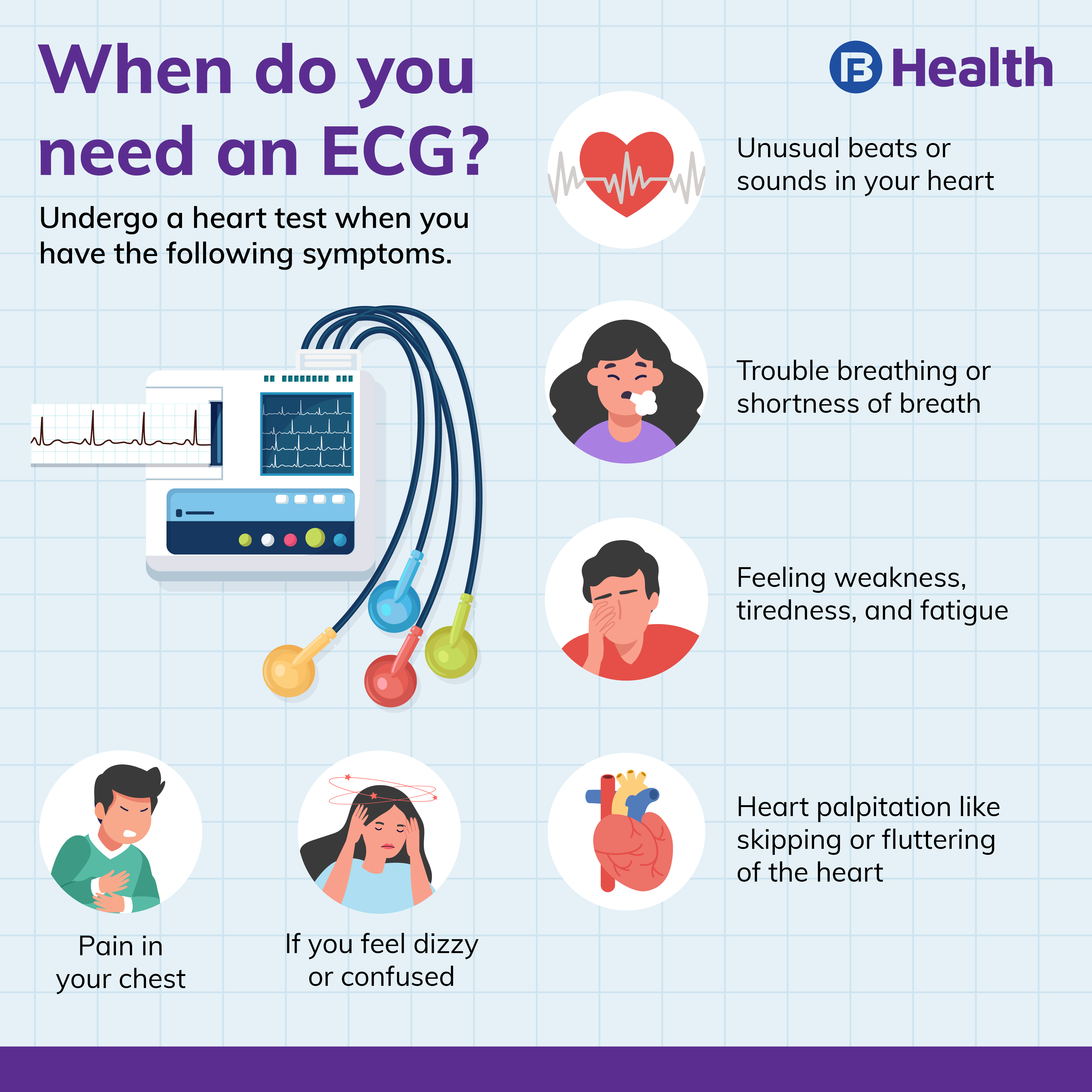 Ekg Arrhythmia