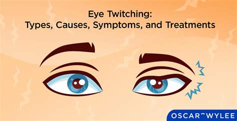 Eye Doctor For Eye Twitching