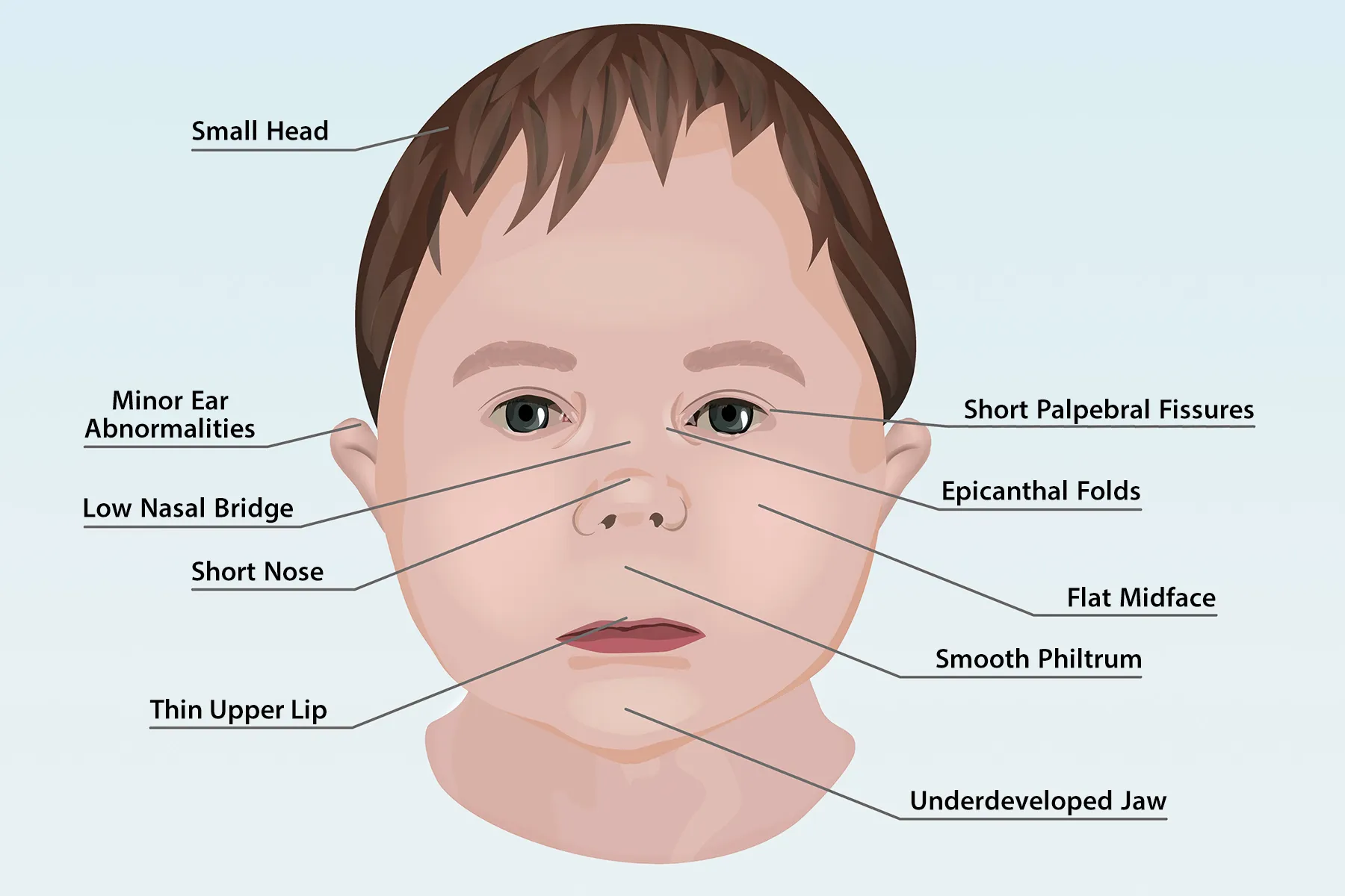 Fetal Heart Tracing