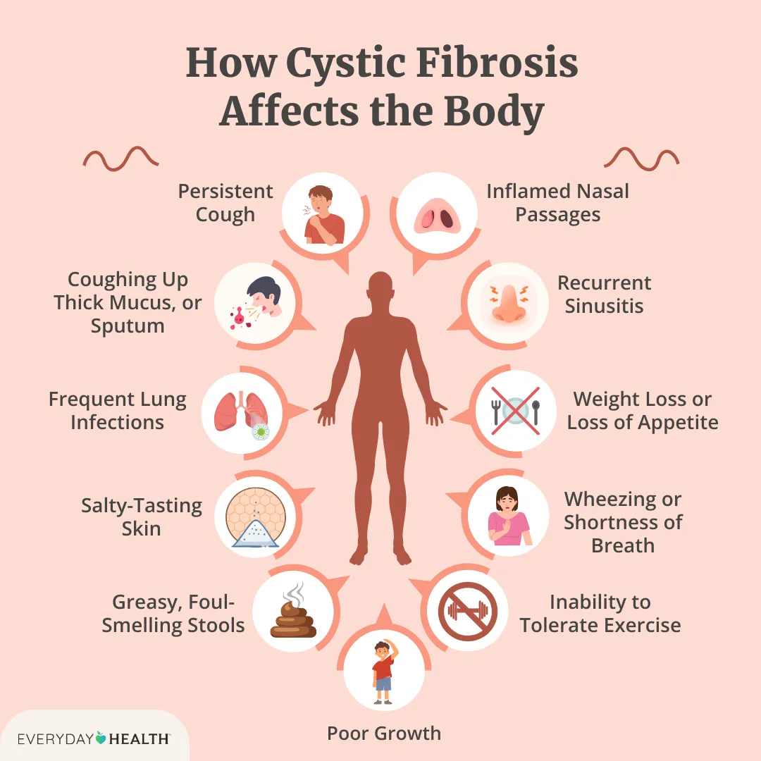 Fibrosis Lung Life Expectancy