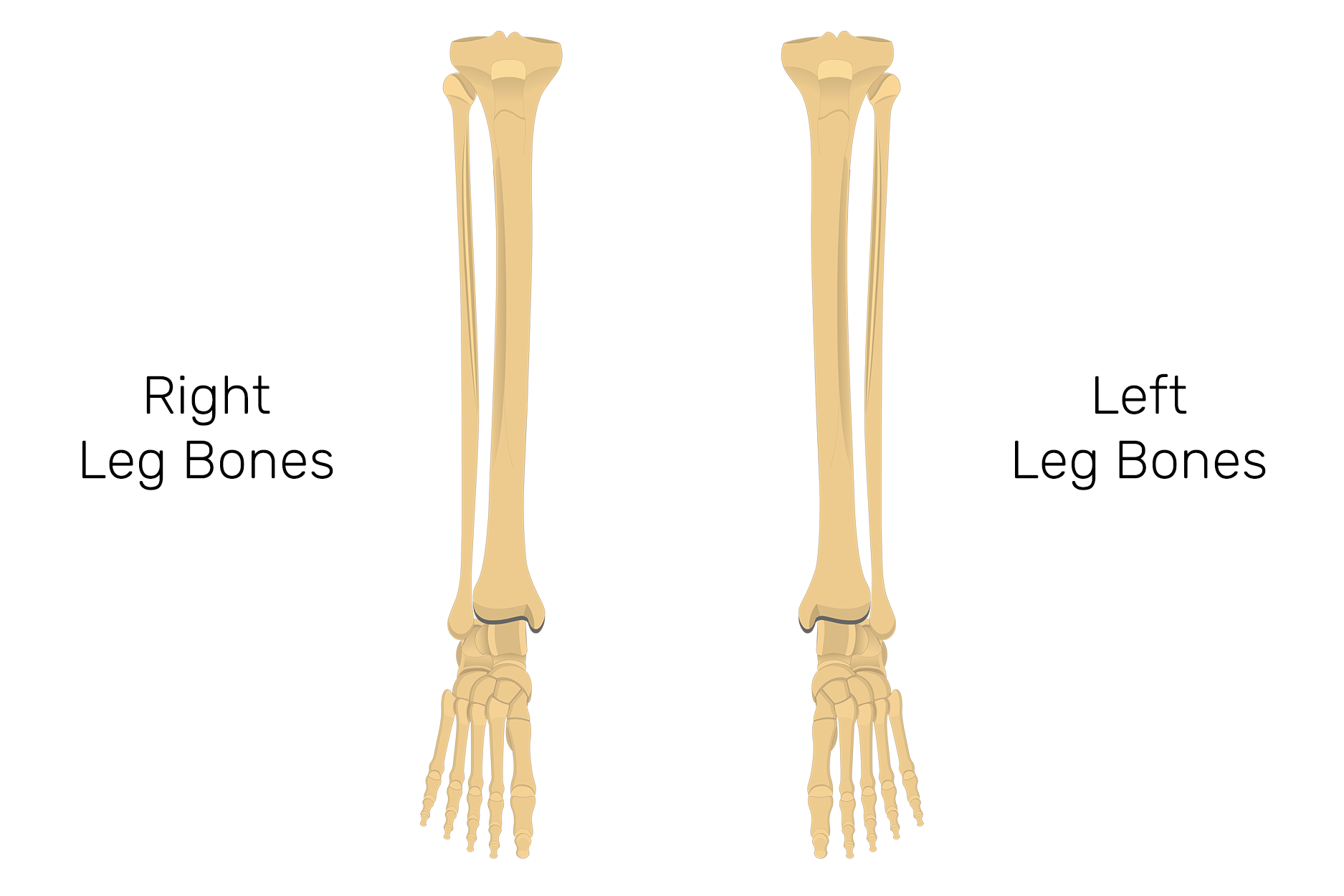 Fibula Stress Fracture