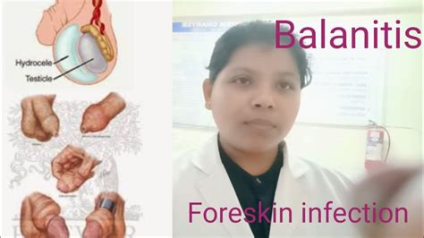 Foreskin Infection Photos