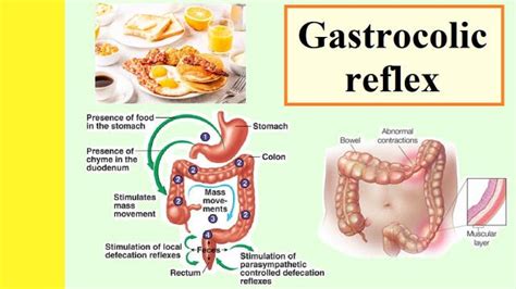 Gastrocolic Reflex Treatment