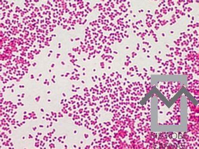 H Influenzae Gram Stain