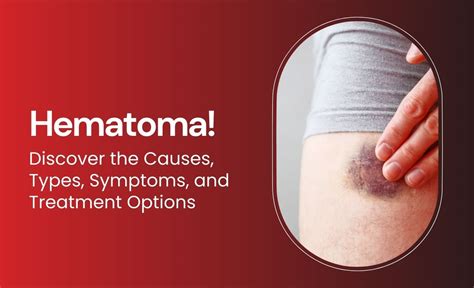 Haematoma Post Surgery