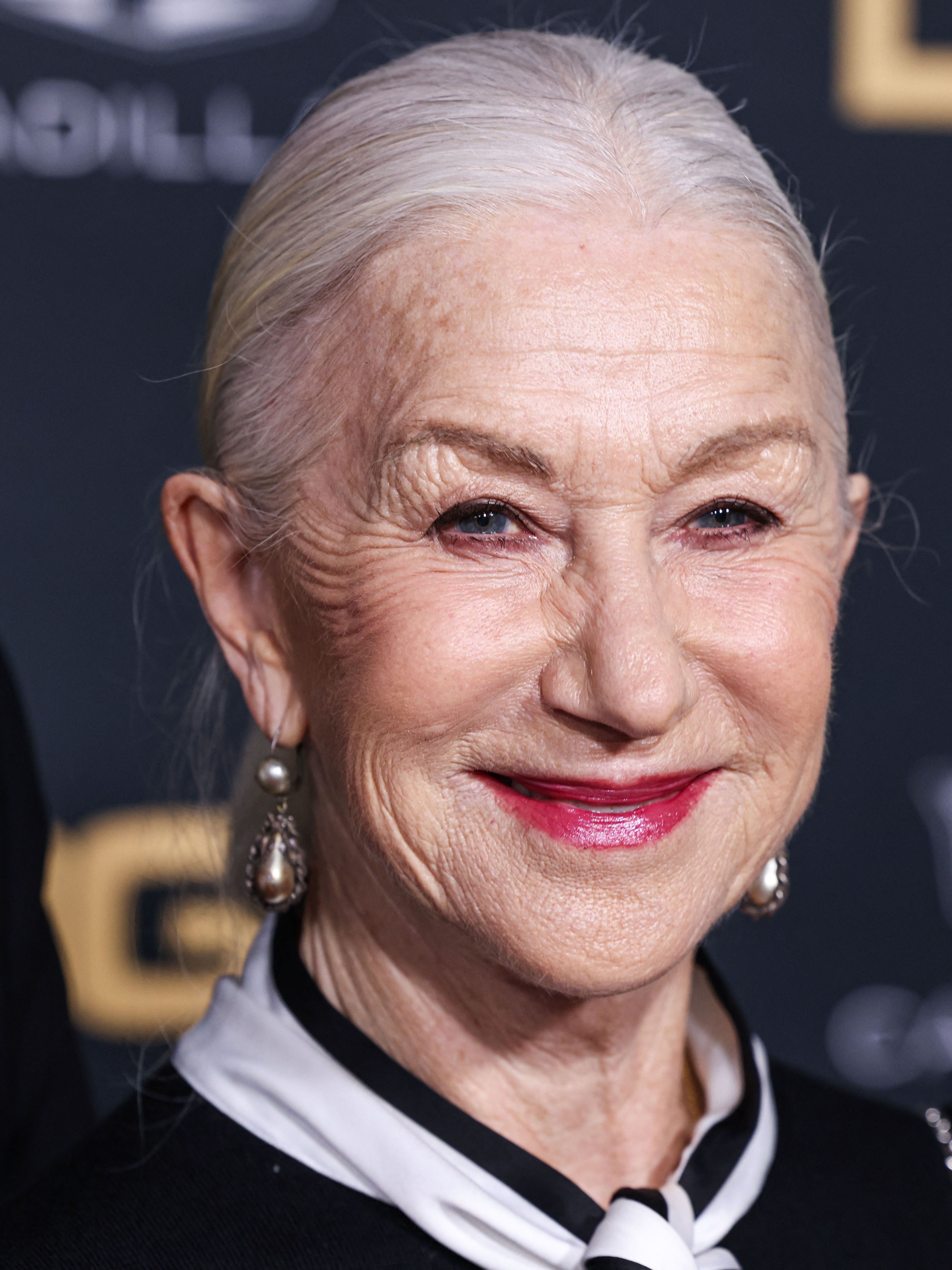 Helen Hunts Face Surgery