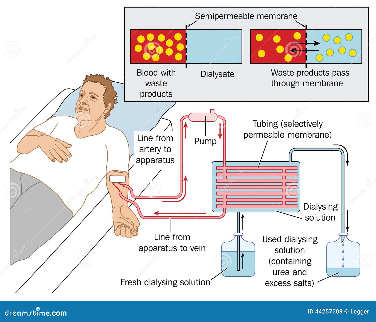How A Dialysis Works: A Simple Guide To Kidney Function