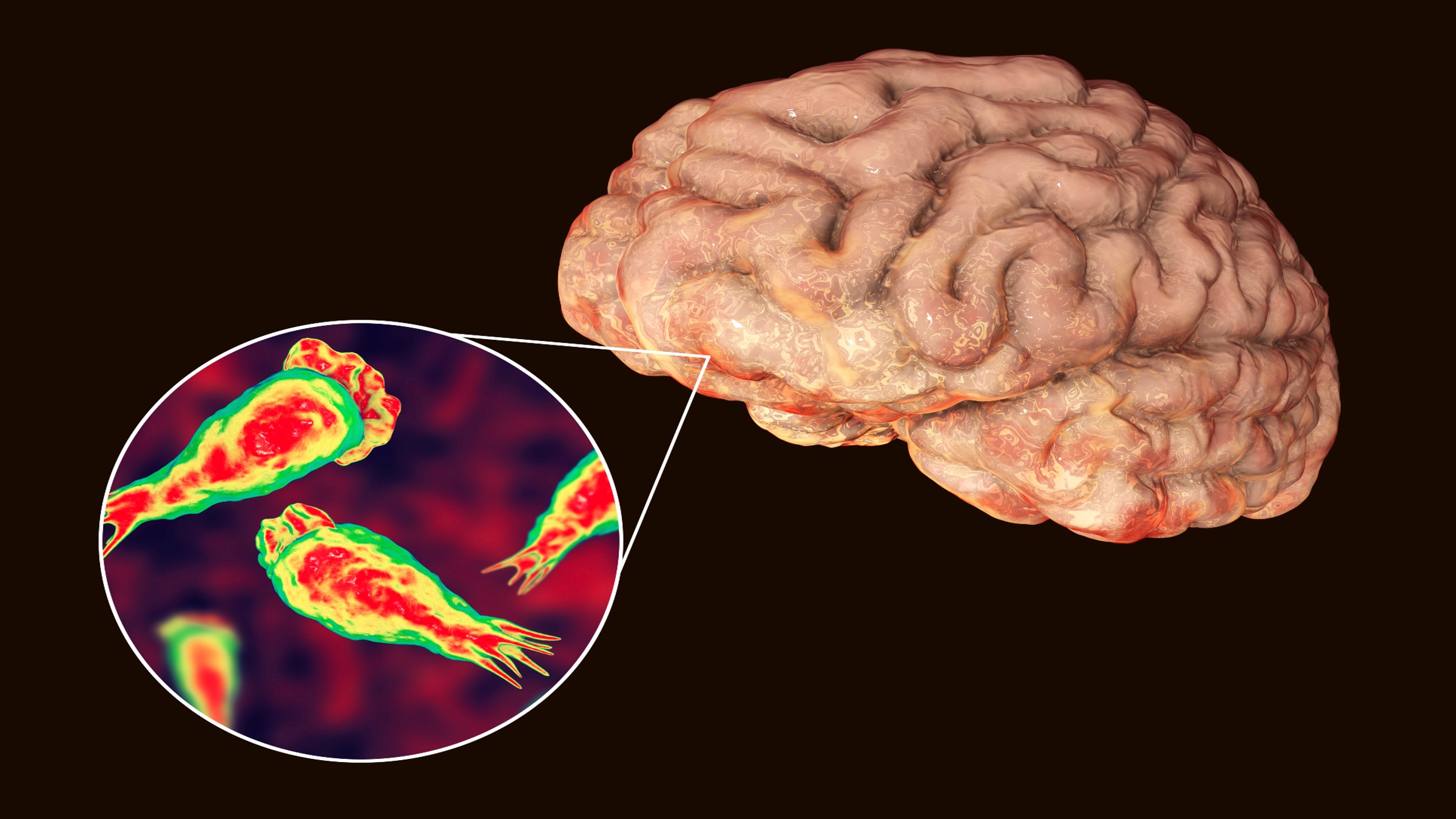 How Braineating Amoeba Enters The Body: A Clear Explanation