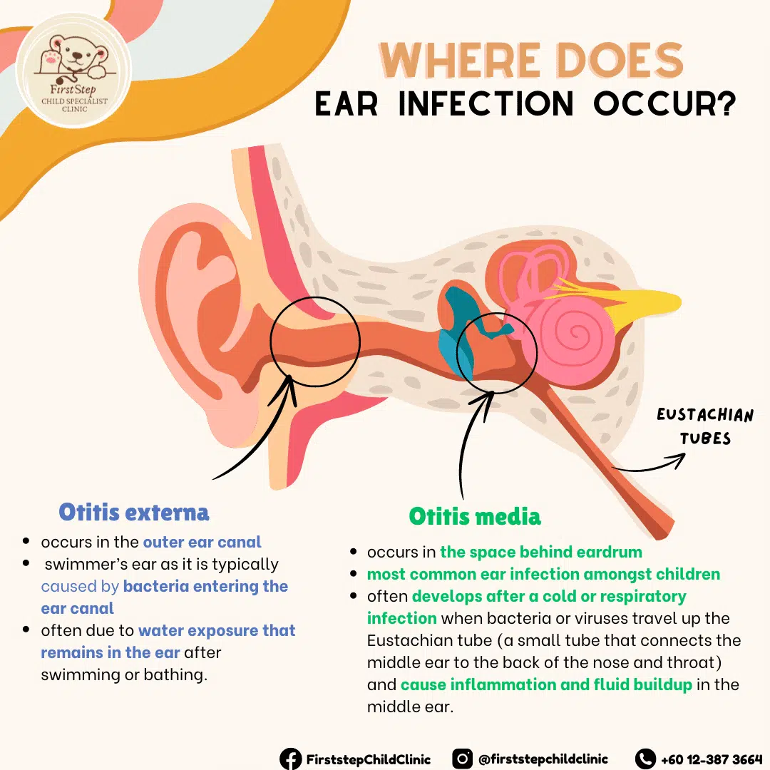 How Brain Infection Occurs: A Clear Guide To Causes And Risks