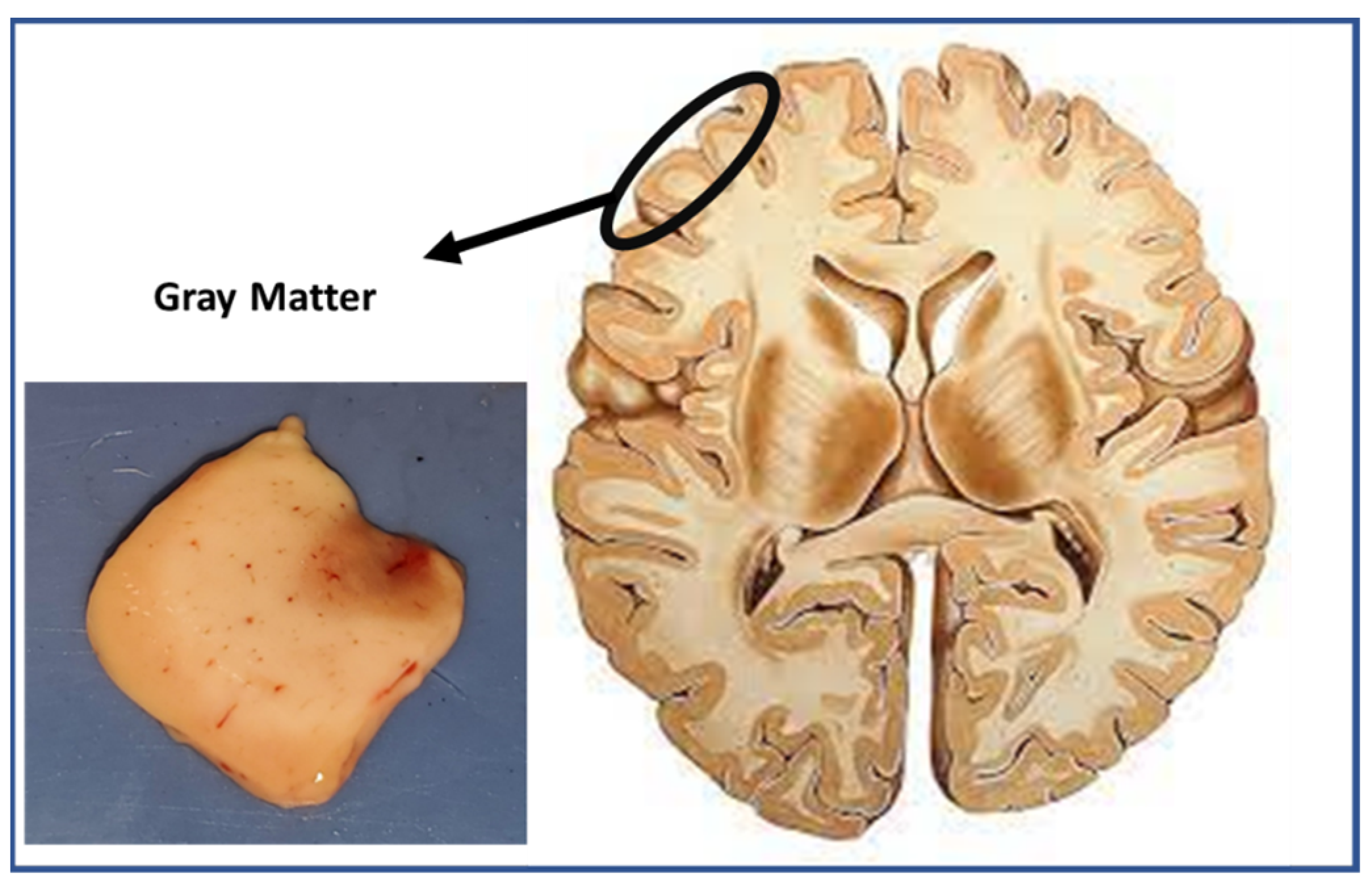 Beyond The Gray Matter: How The Human Brain Actually Looks