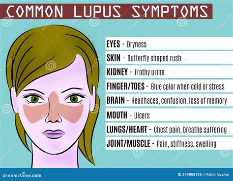 How Common Is Lupus