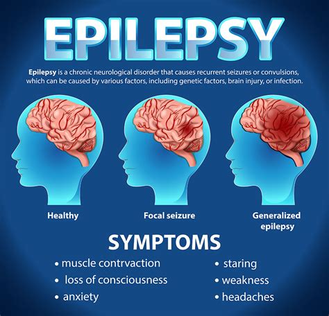 How Dangerous Is Epilepsy
