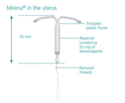 How Does Mirena Work