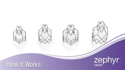 How Does Zephyr Work
