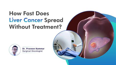 How Fast Does Cancer Spread