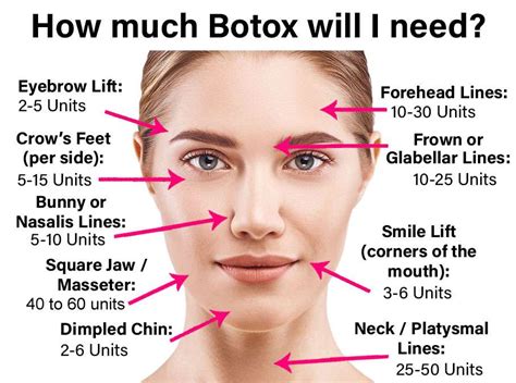 How Long Does Take Botox To Work