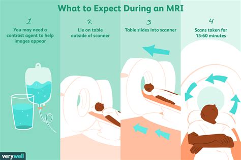 How Long For Mri Results