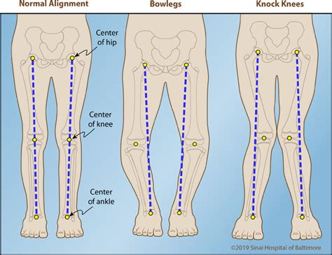 How Many Knees Do We Have