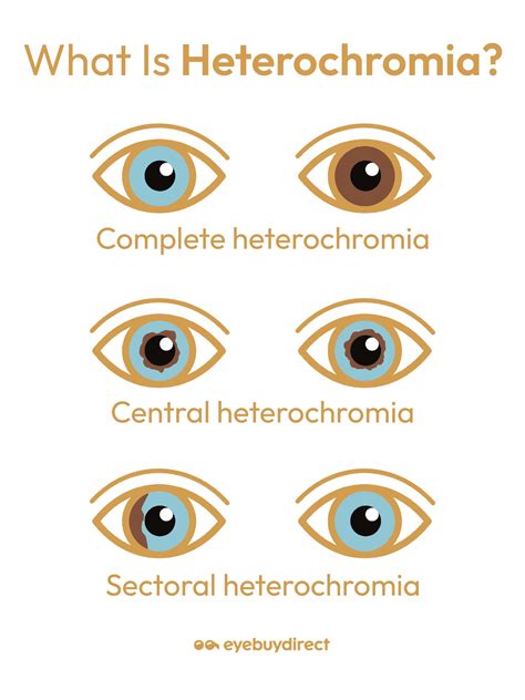 How Rare Is Heterochromia