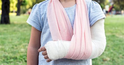 How To Break Your Arm