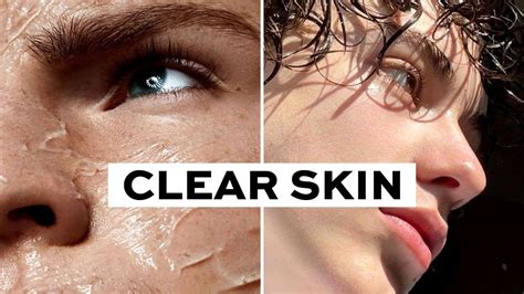 How To Have Clear Skin